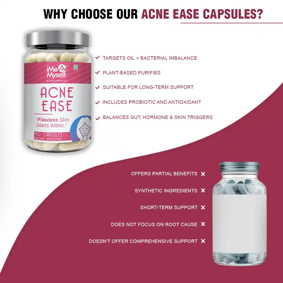 Acne Ease