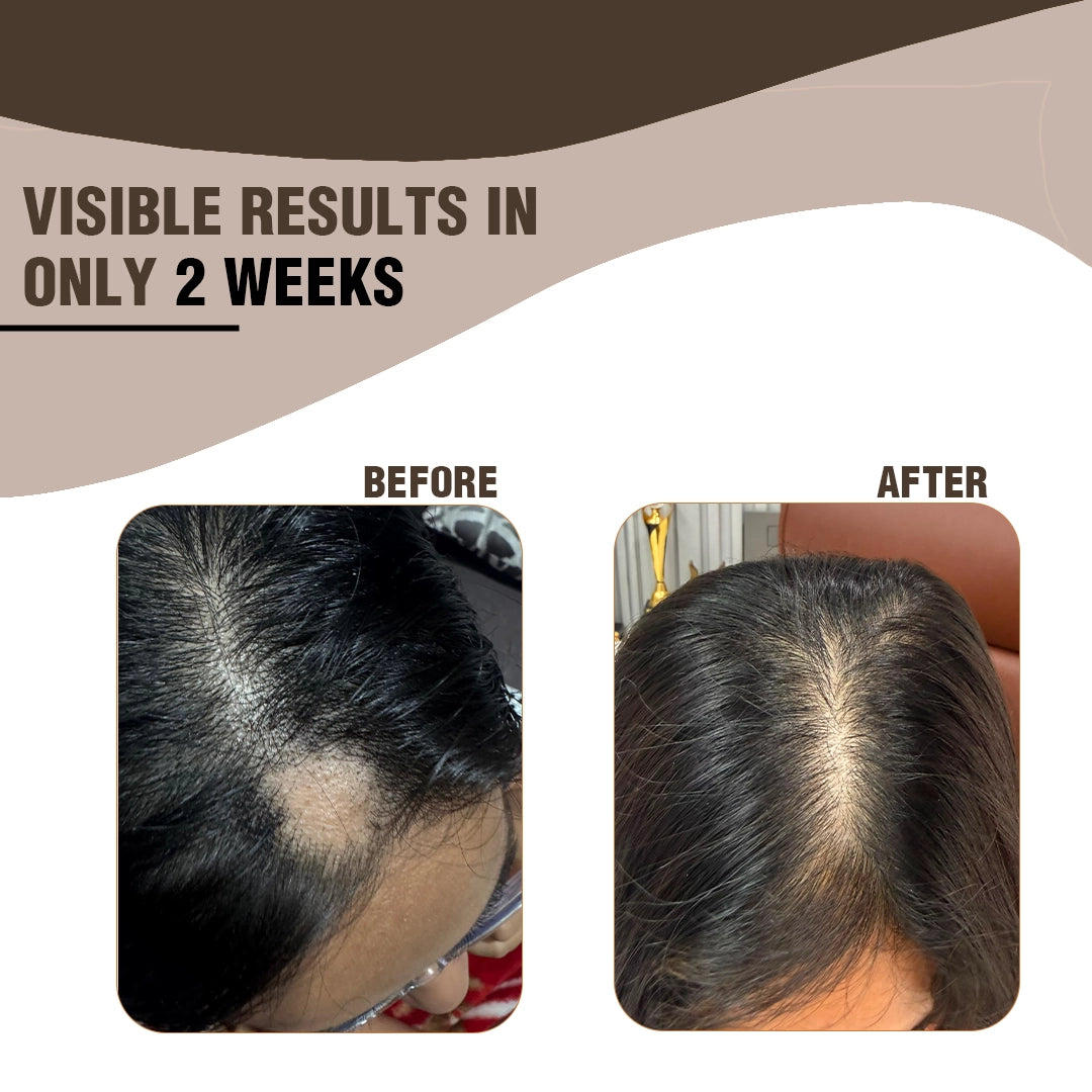 Hair Boost